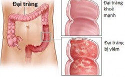 viem dai trang