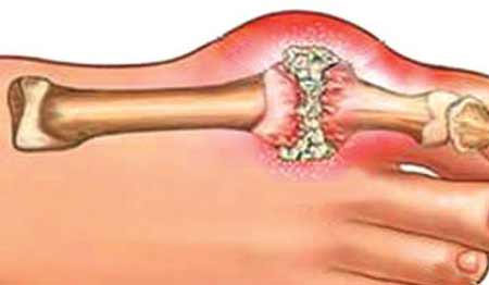 Hỏi đáp về sản phẩm Hoàng Thống Phong 1 Hỏi đáp về sản phẩm Hoàng Thống Phong 1