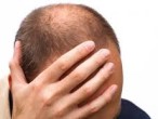 Tổng hợp câu hỏi về Maxxhair Tổng hợp câu hỏi về Maxxhair