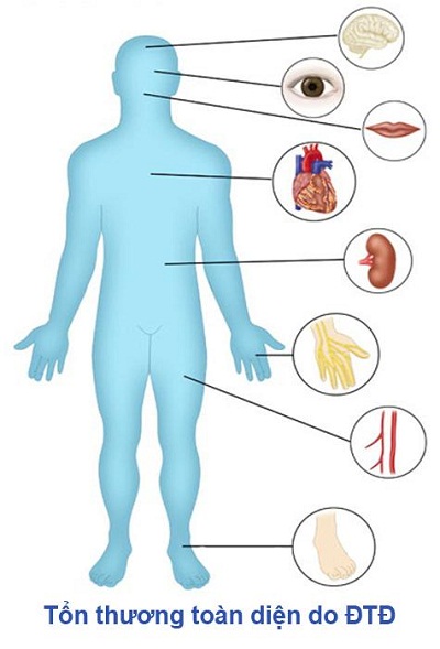 Hộ tạng đường: Phòng ngừa, hỗ trợ điều trị đái tháo đường 1 Hộ tạng đường: Phòng ngừa, hỗ trợ điều trị đái tháo đường 1