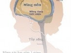 Những điều bạn nên biết về bệnh viêm màng não