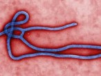 Virus Ebola – Những điều cần biết