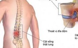 tải xuống